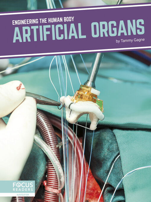 Title details for Artificial Organs by Tammy Gagne - Available